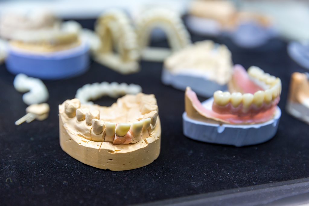 qué es la resina 3d dental