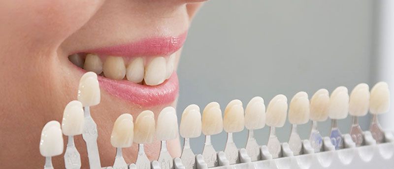¿Qué es la Resina 3D Dental?